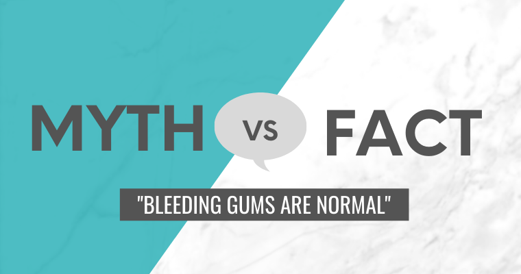 Text: Myth vs. fact "Bleeding gums are normal"