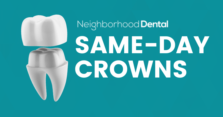Same Day Dentistry: CEREC Crowns