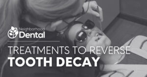Treatments to Reverse Tooth Decay